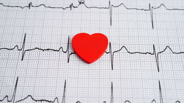 Ausdruck eines Eckokardiogramms (EKG) 