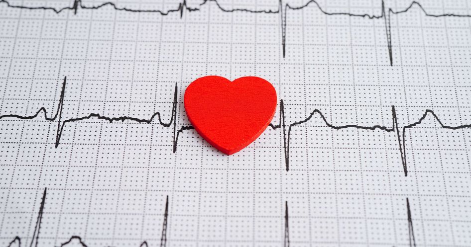 Ausdruck eines Eckokardiogramms (EKG) 