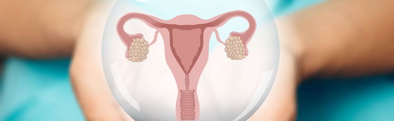 Uterusmyom