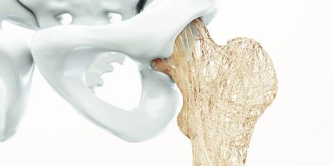 Osteoporose 