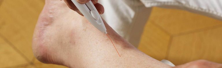 Elektromyografie am Bein