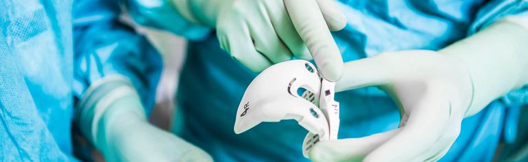 Endoprothese – Hinweise für Patienten