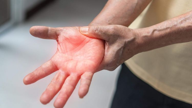 Schmerzende Hand bei Polyneuropathie
