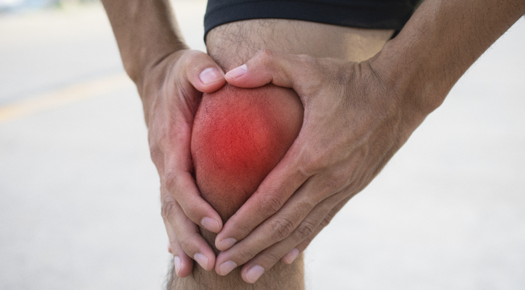 Knieschmerzen durch Arthrose