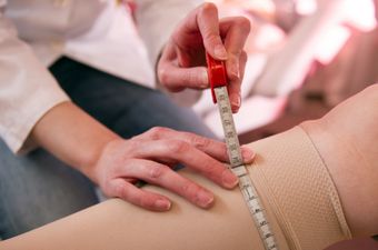 Thrombose: Symptome, Ursachen, Behandlung