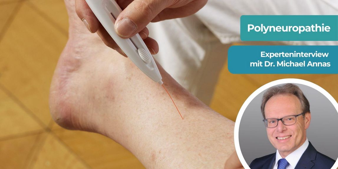 Dr. med. Michael Annas, Beindiagnostik Polyneuropathie