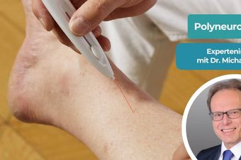 Dr. med. Michael Annas, Beindiagnostik Polyneuropathie