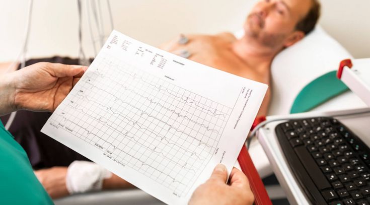 Diagnose Herzinfarkt: EKG