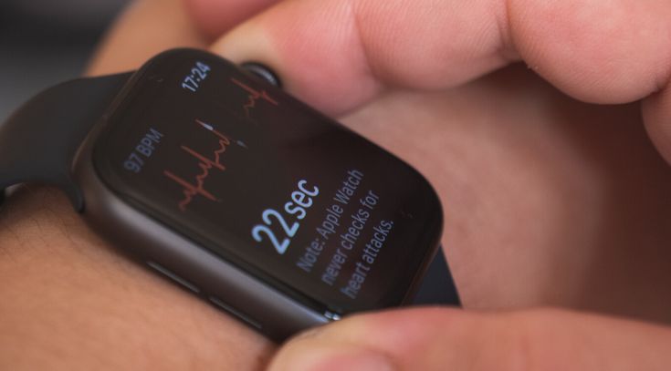 EKG Smart Watch