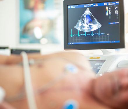 Kardiomyopathie: Symptome & Behandlung