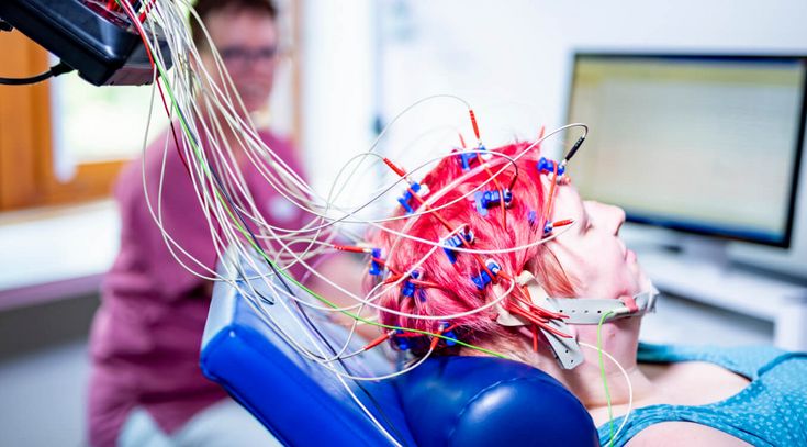 EEG bei Epilepsie