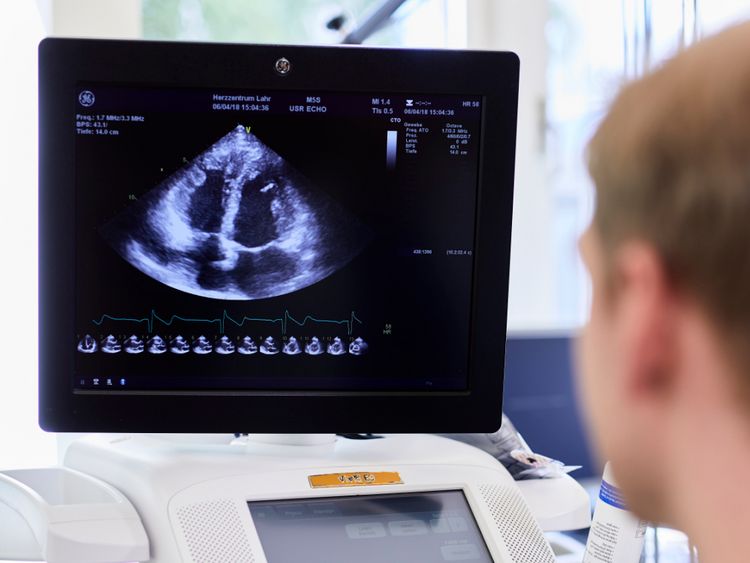 EKG bei Herzinsuffizienz