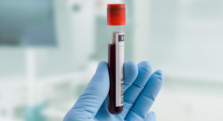 Blutprobe