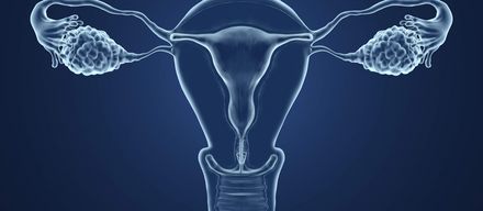 Gynäkologische Tumoren – Symptome & Behandlung