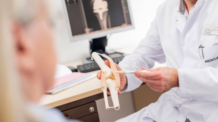 Arzt erläutert Patienten die Funktion des Kniegelenks an einem Knochenmodell
