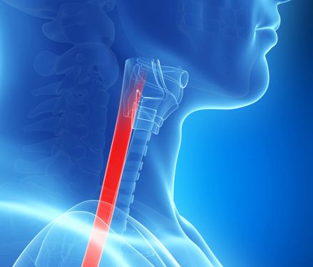 Speiseröhrenkrebs Speiseröhrenkrebs – Ursachen, Symptome, Behandlung