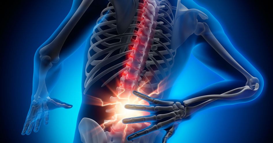 Rückenschmerzen an Skelett