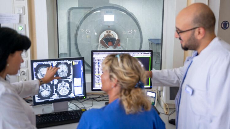 Computertomografie bei Epilepsie